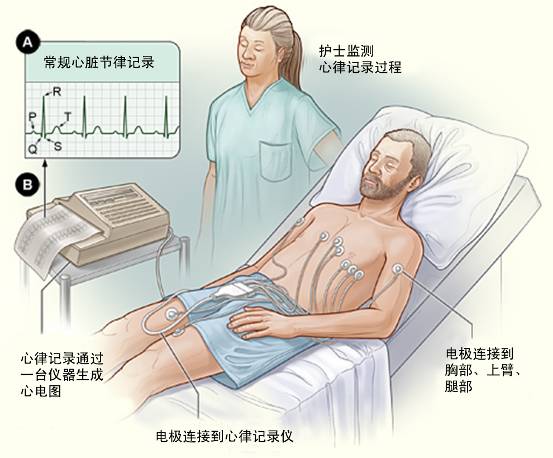 冠心病需要做哪些檢查？(圖1)