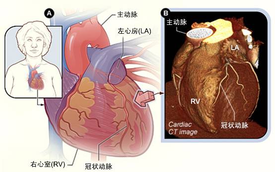 冠心病需要做哪些檢查？(圖2)